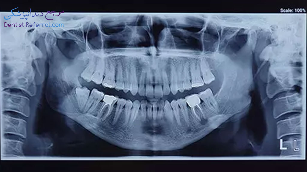 کیلینیک تخصصی رادیولوژی دهان، فک و صورت دکتر مریم خانی