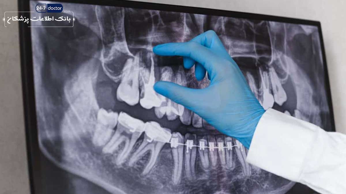 بهترین دندانپزشک عصب کشی دندان در شیراز