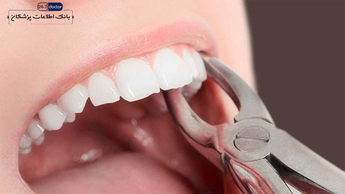 دندانپزشک متخصص کشیدن دندان در شیراز
