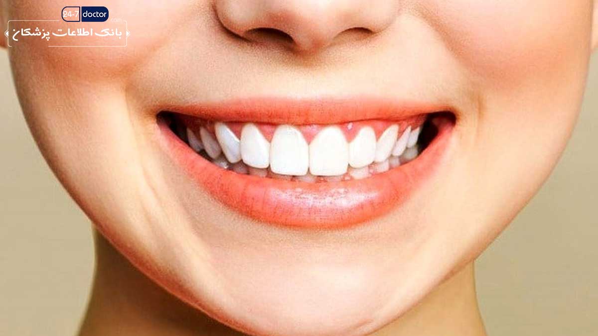 دندانپزشک متخصص طراحی لبخند در شیراز