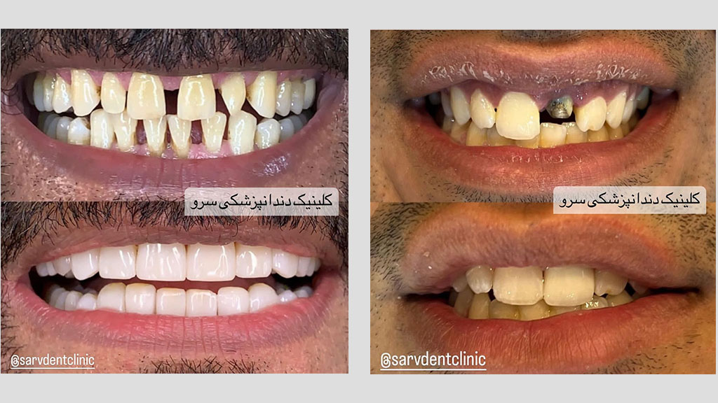 کلینیک دندانپزشکی سرو